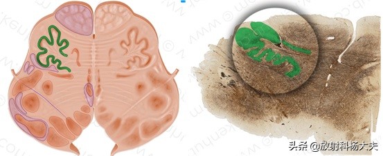 放射科趣味图片,放射科亮点图片