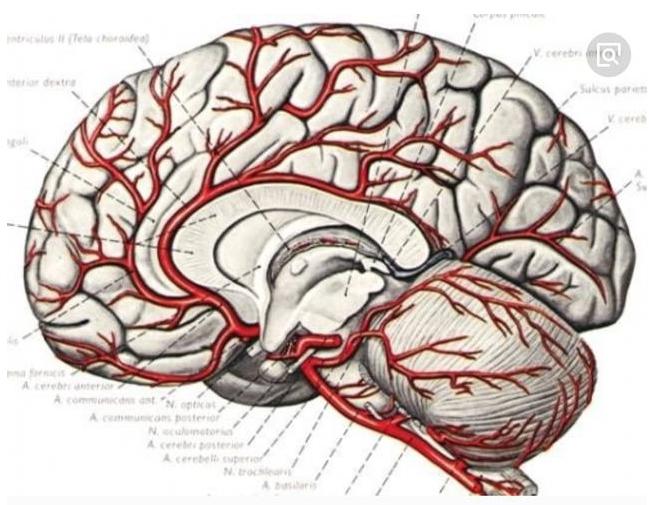 中风导致偏瘫是怎么回事,中风脑梗半边瘫痪治疗过程