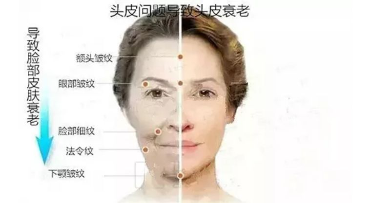 日本滋润头发防脱发的洗发水,日本洗发水头发干枯毛躁