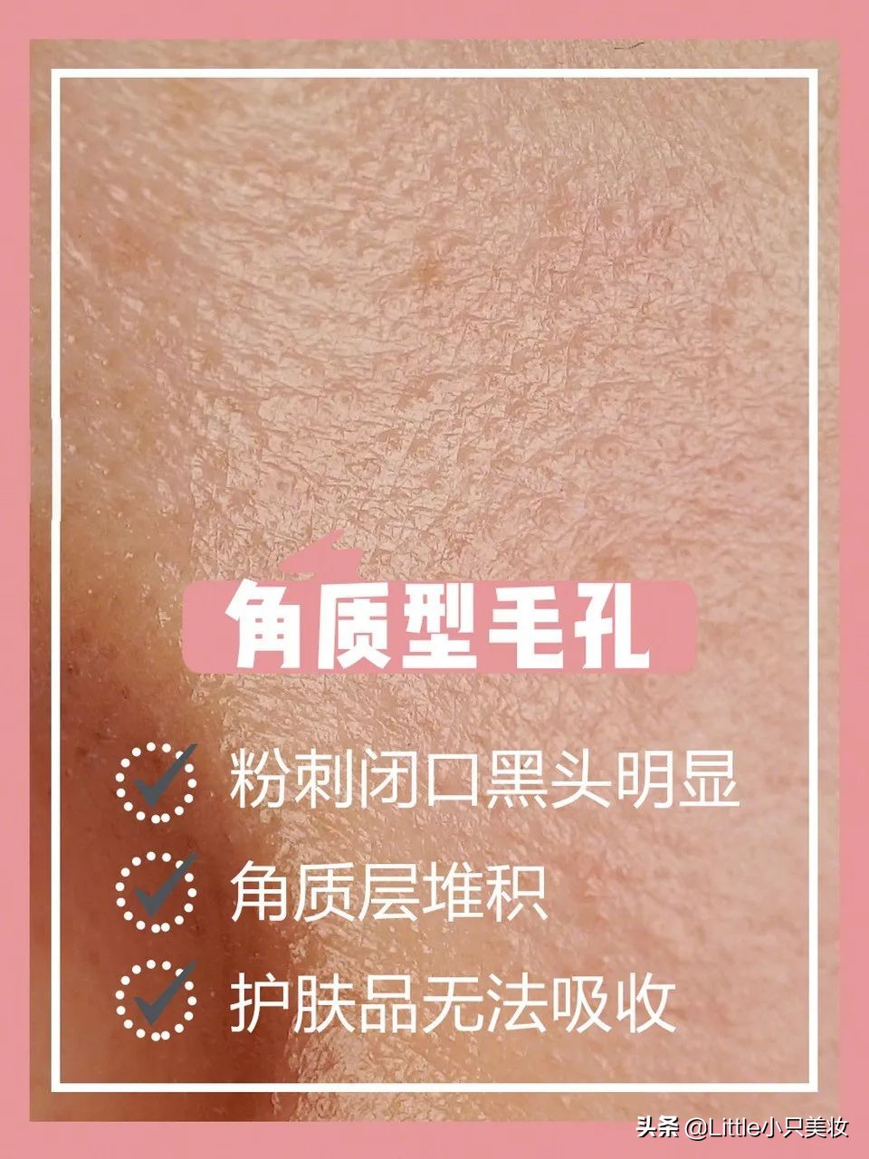 有了这5个护肤秘诀颜值不下降,有效改善毛孔粗大的好物推荐