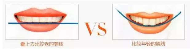 怎么样微笑才能又好看又自然,微笑攻略
