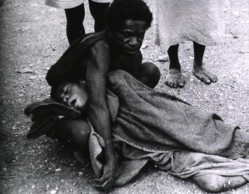 致死率百分百疾病,感染朊病毒有多可怕