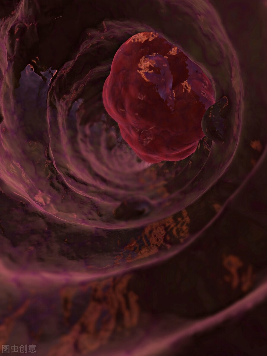 肠息肉都要切除吗?术后护理事项有?