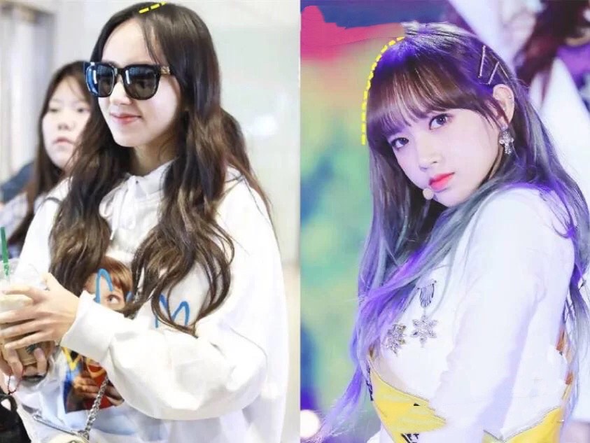 发量少发际线高怎么补救男,额头发际线太高会影响颜值