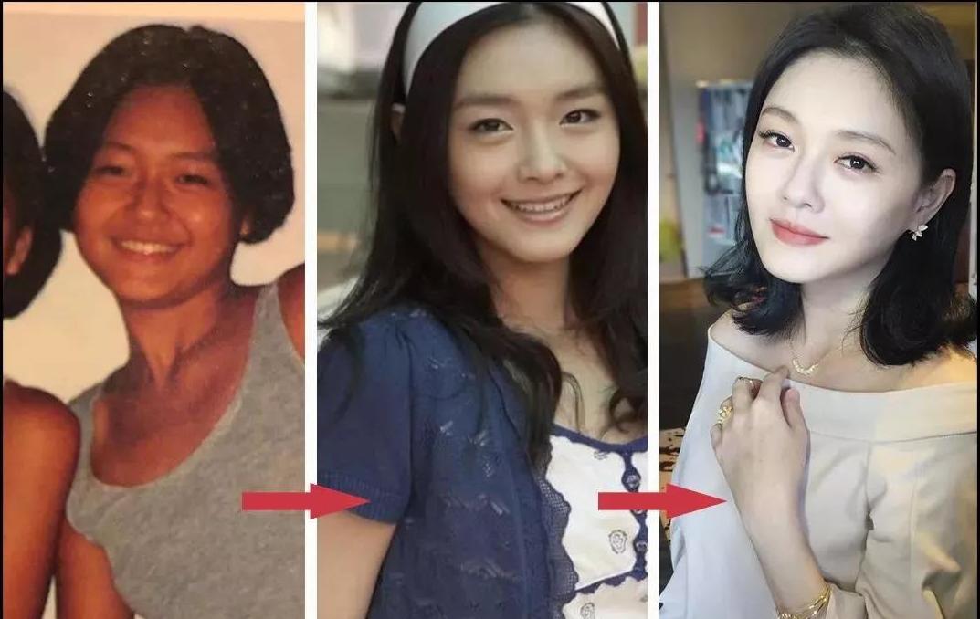 泰国女子打6年美白针六胜肽,女子打美白针后身患多病