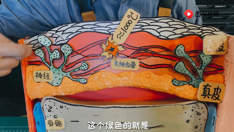 深二度烫伤和浅二度烫伤对比图片,烫伤的泡变暗红色