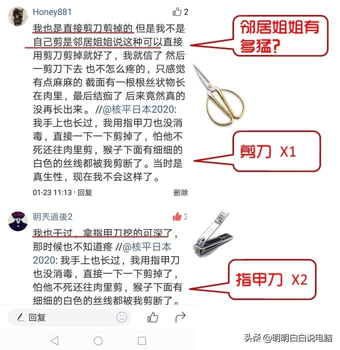 一招处理瘊子,无公害处理瘊子