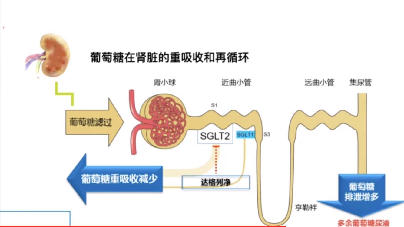 糖尿病治疗中，哪些是一线用药，哪些是二线用药？如何选择？