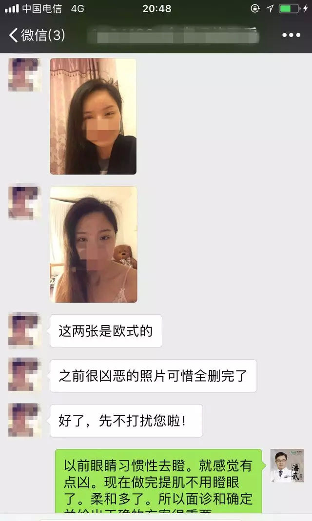 双眼皮手术后眼神凶狠是什么原因,双眼皮手术后显凶