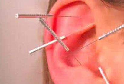 颈椎病的最快最有效的锻炼方法,7个有效的颈椎病的自我治疗方法