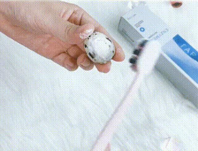 刘涛全瓷牙经验之谈,为什么刘涛说不要轻易做全瓷牙