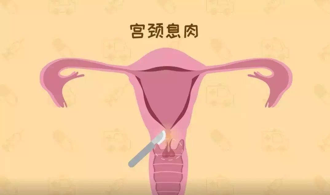 为啥啪啪啪过的女性，90%都会“喉咙”发炎？