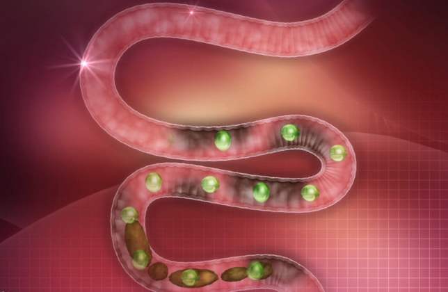 宿便堆积体内有什么危害,肠道清理宿便最好方法