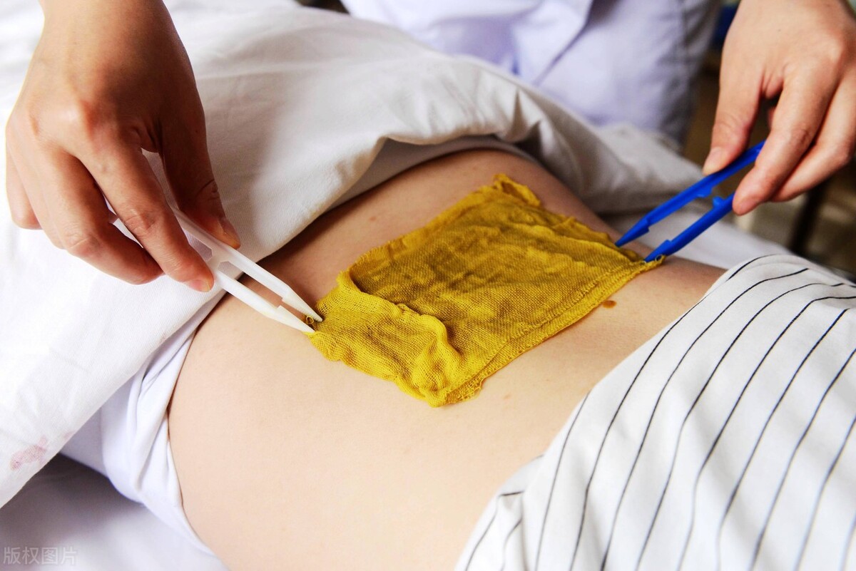 中药硬膏热贴敷的说明书,中药硬膏热贴敷怎么保存