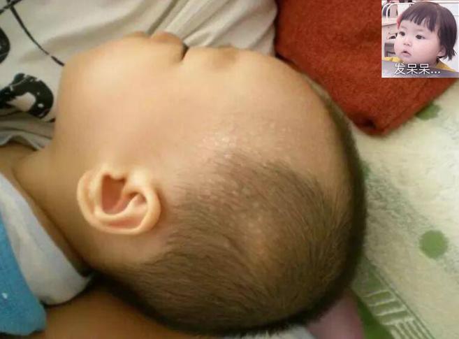 孩子睡觉缺钙的症状,宝宝睡觉盗汗缺钙怎么办