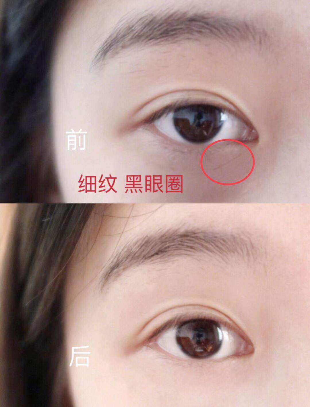 有句话说得好:美不美看脸,老不老看眼