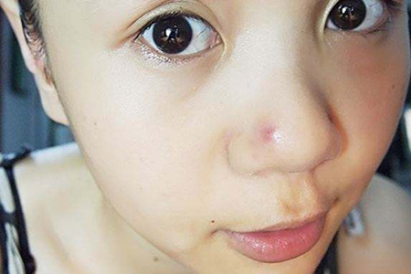 好用祛痘国货老品牌推荐,国货祛痘最好的牌子