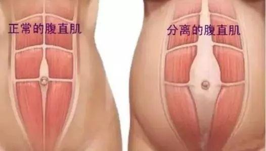 瑜伽教学课程，产后修复瑜伽课，宝妈们快收藏起来吧！