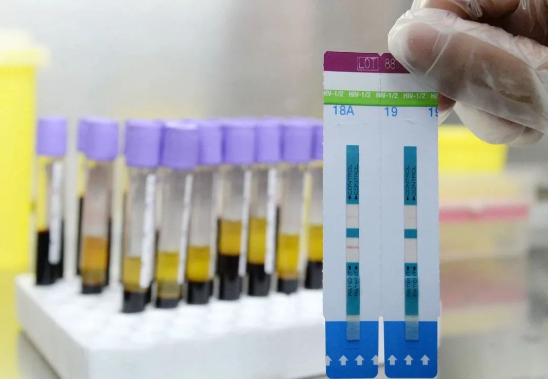 你离艾滋病远吗,与艾滋病患者的沟通距离