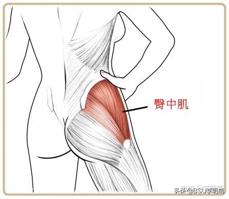 x型腿该怎么解决呢,x型腿怎么治