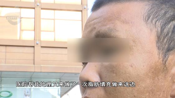 张嘴会响左右不对称!30岁小伙花三万“去颧骨”失败找院方协商还想再做手术