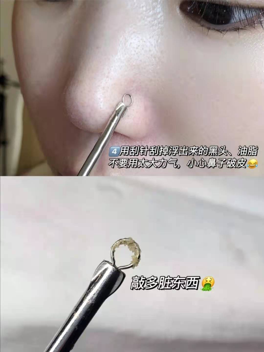 去黑头收缩毛孔的最好方法洗面奶,去黑头收缩毛孔的最好方法多少钱