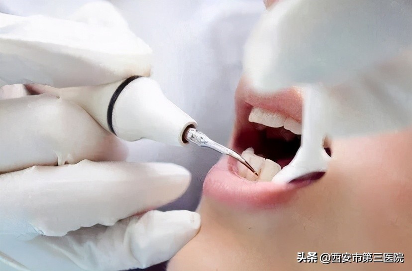 北大口腔洗牙收费标准,南京口腔医院洗牙流程