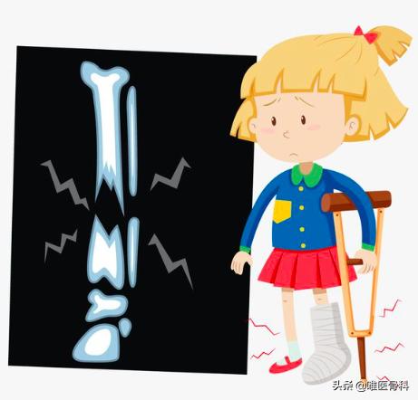 不小心摔伤骨折了怎么办,户外骨折怎么办