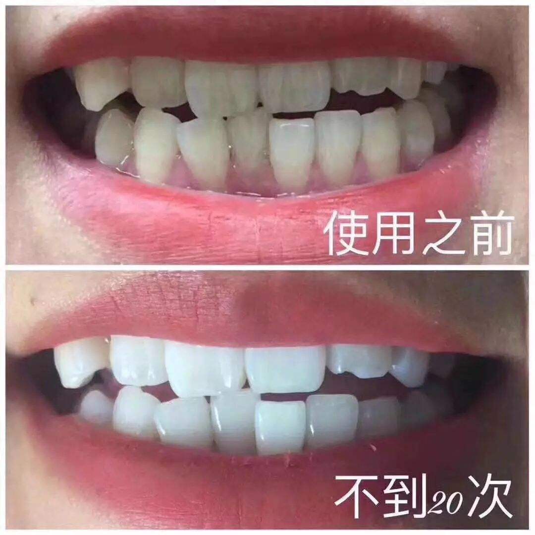 全球10款真正好用的人气牙膏,盘点全球9款真正好用的人气牙膏