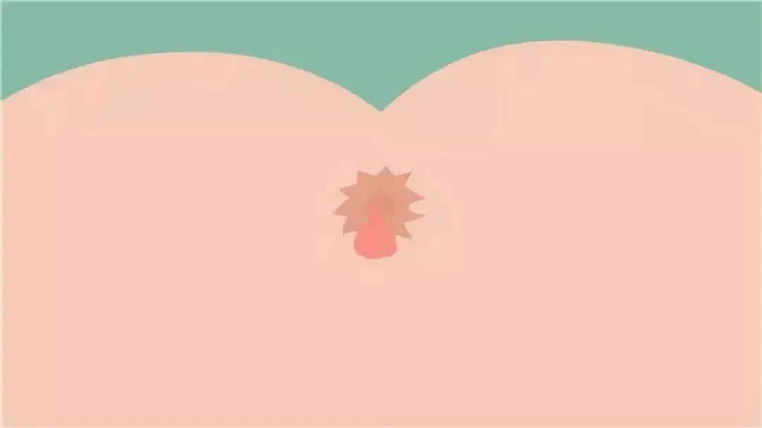 肛门处长疙瘩一定是痔疮？也许这些疾病在作怪