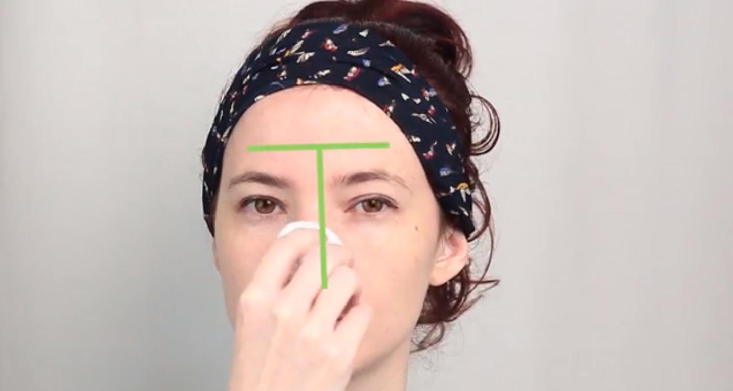 秋冬季节皮肤起痘痘,换季皮肤起闭口痘痘