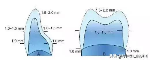 氧化锆全瓷牙价格表,氧化锆全瓷牙和全瓷冠