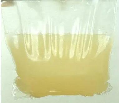 腹膜透析出现腹膜炎的护理措施,腹膜透析居家注意事项