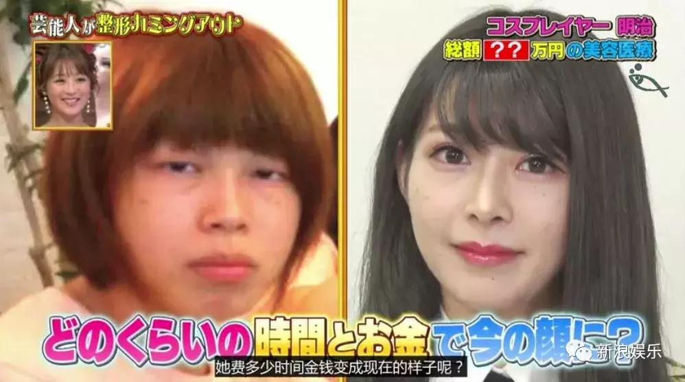 那些整容脸真的觉得自己好看吗,为什么整容以后都是一样的网红脸