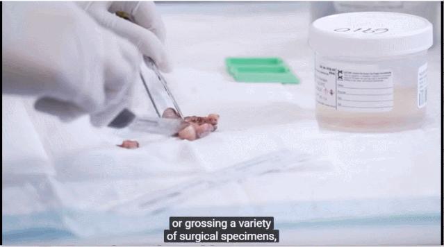 病理报告为什么这么慢,手术后病理报告准确率高吗