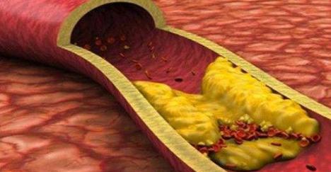 吃完羊肉上火吃什么水果可以解决,冬季吃羊肉多再吃什么就不会上火