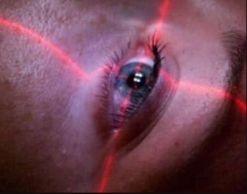 近视550-450度应该如何矫正,近视550多度严重吗十四岁