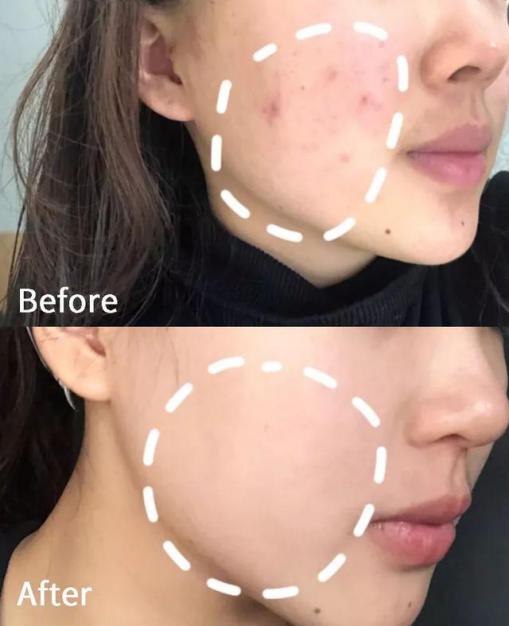 不老女神明星李英爱,51岁李英爱冻龄神颜的原因