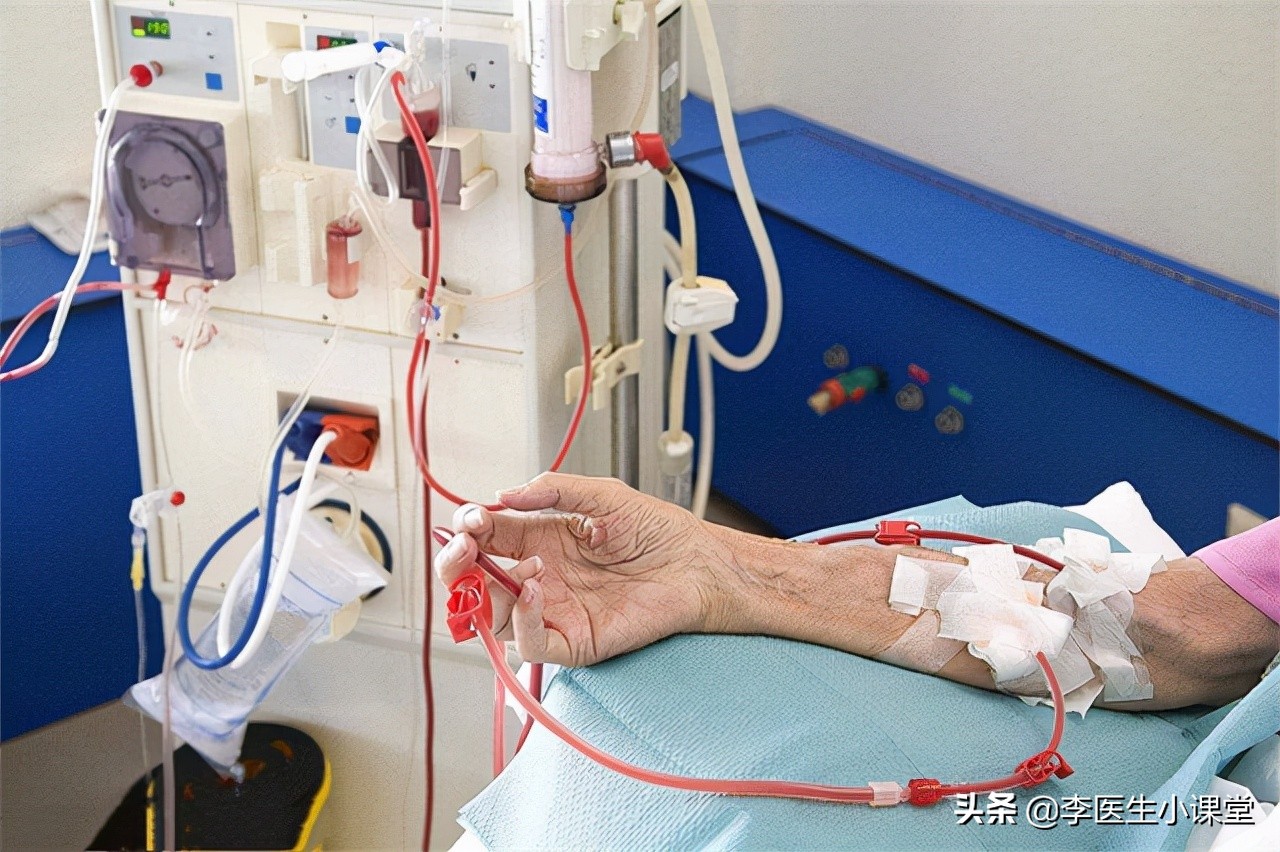 肾不好要怎么办？坚持做好这3点，有助于预防肾衰竭