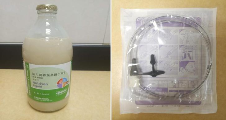 气管切开脱管不良事件原因分析,气管切开患者堵管流程