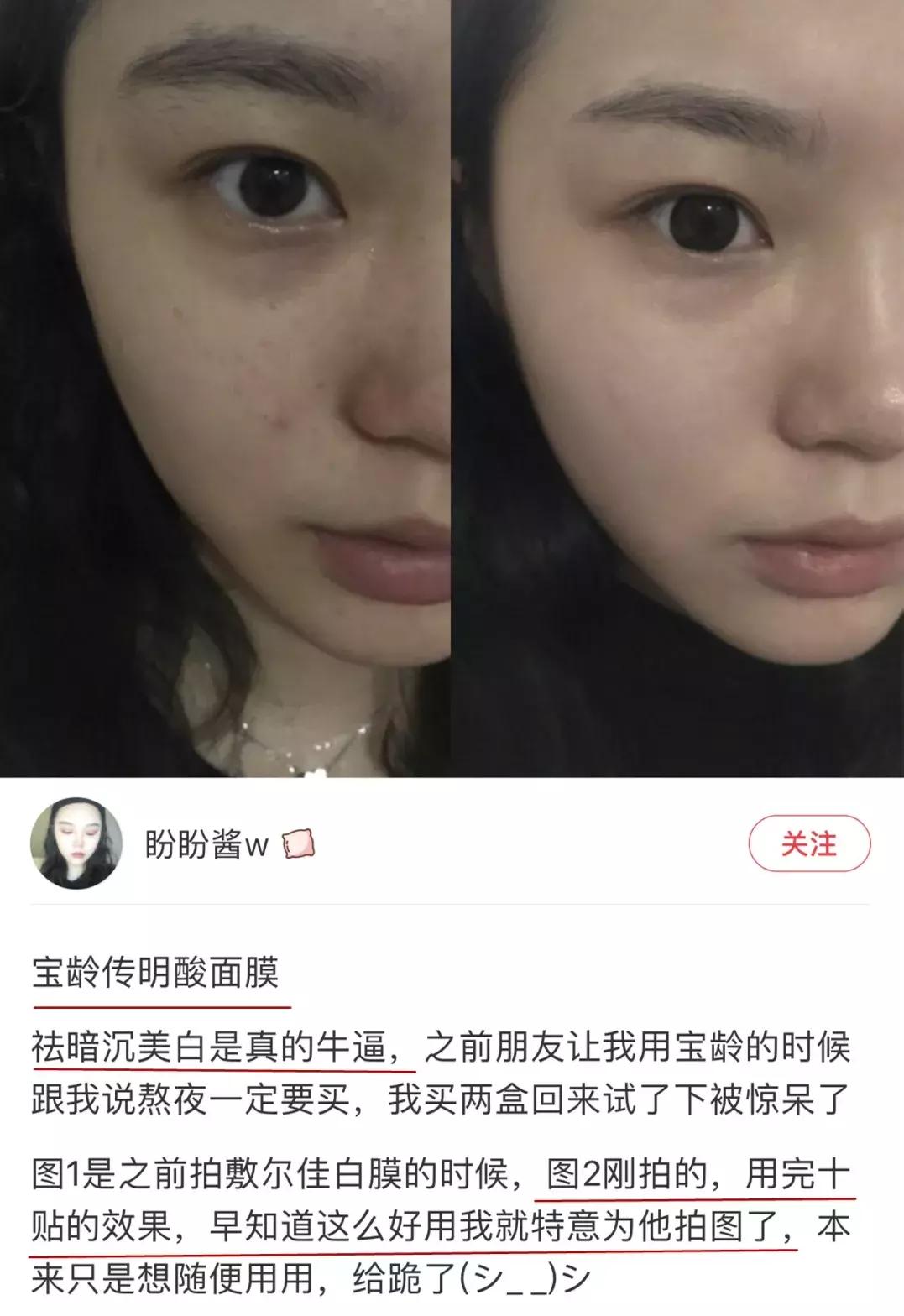 日常这些护肤误区千万不要踩,十大护肤烂脸成分