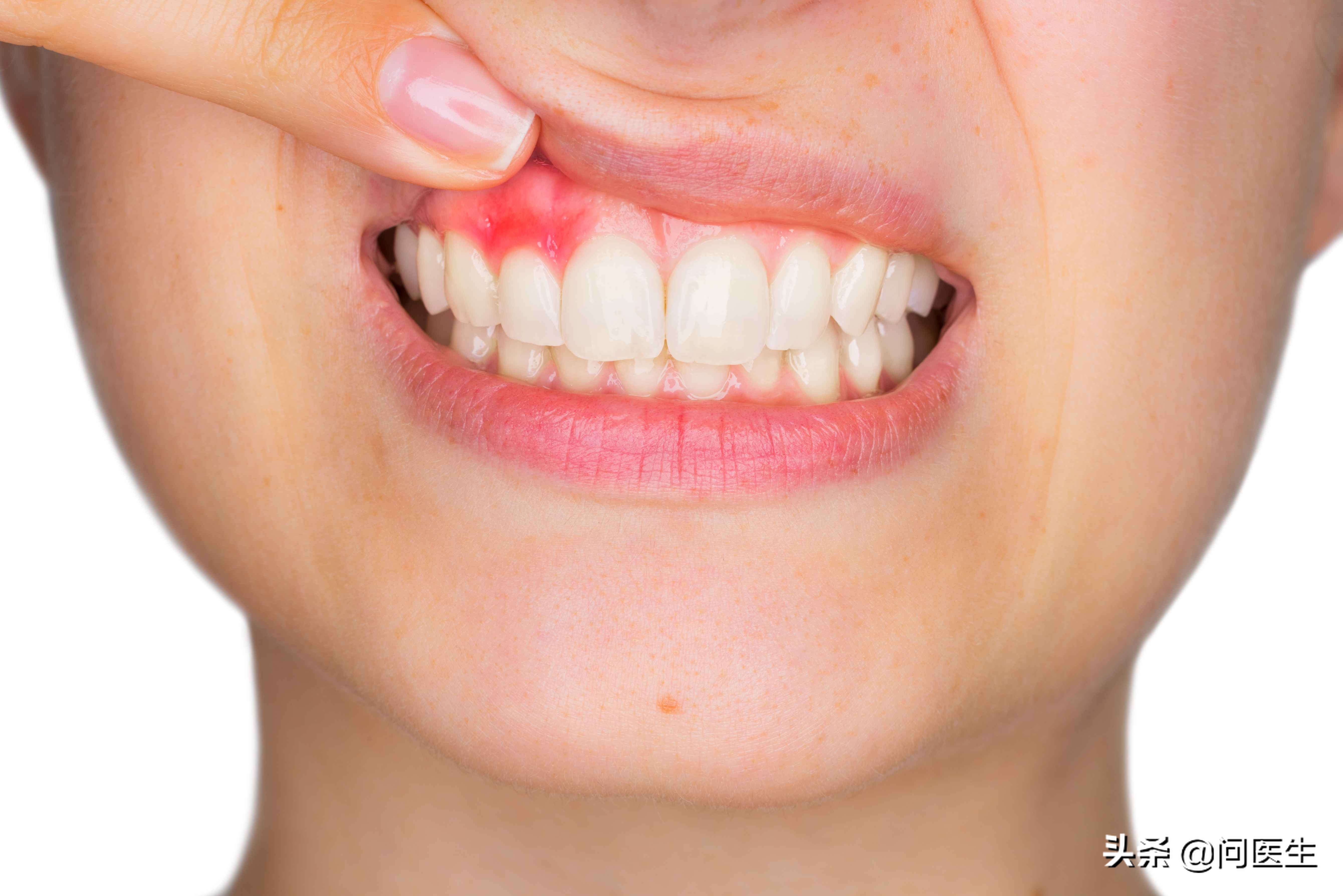 备孕期间，请记得3种牙病要早检查！对怀孕会有影响