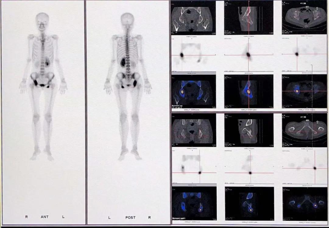 “显”为人知的核医学“神秘”——小“核”才露尖尖角
