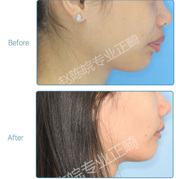 杭州口腔医院整牙,杭州整牙医生怎么选