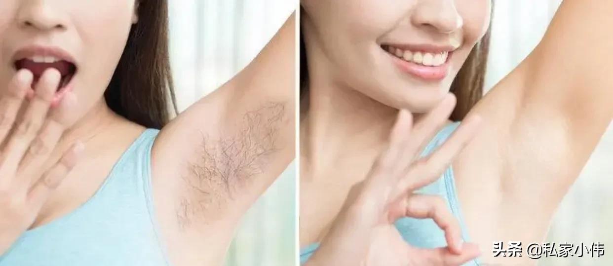 女生毛发过重的原因有哪些,女生毛发旺盛是什么原因引起的