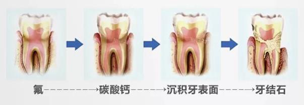 花1000块洗牙美白，效果输给一支烟民牙膏！新西兰人用它白了97年