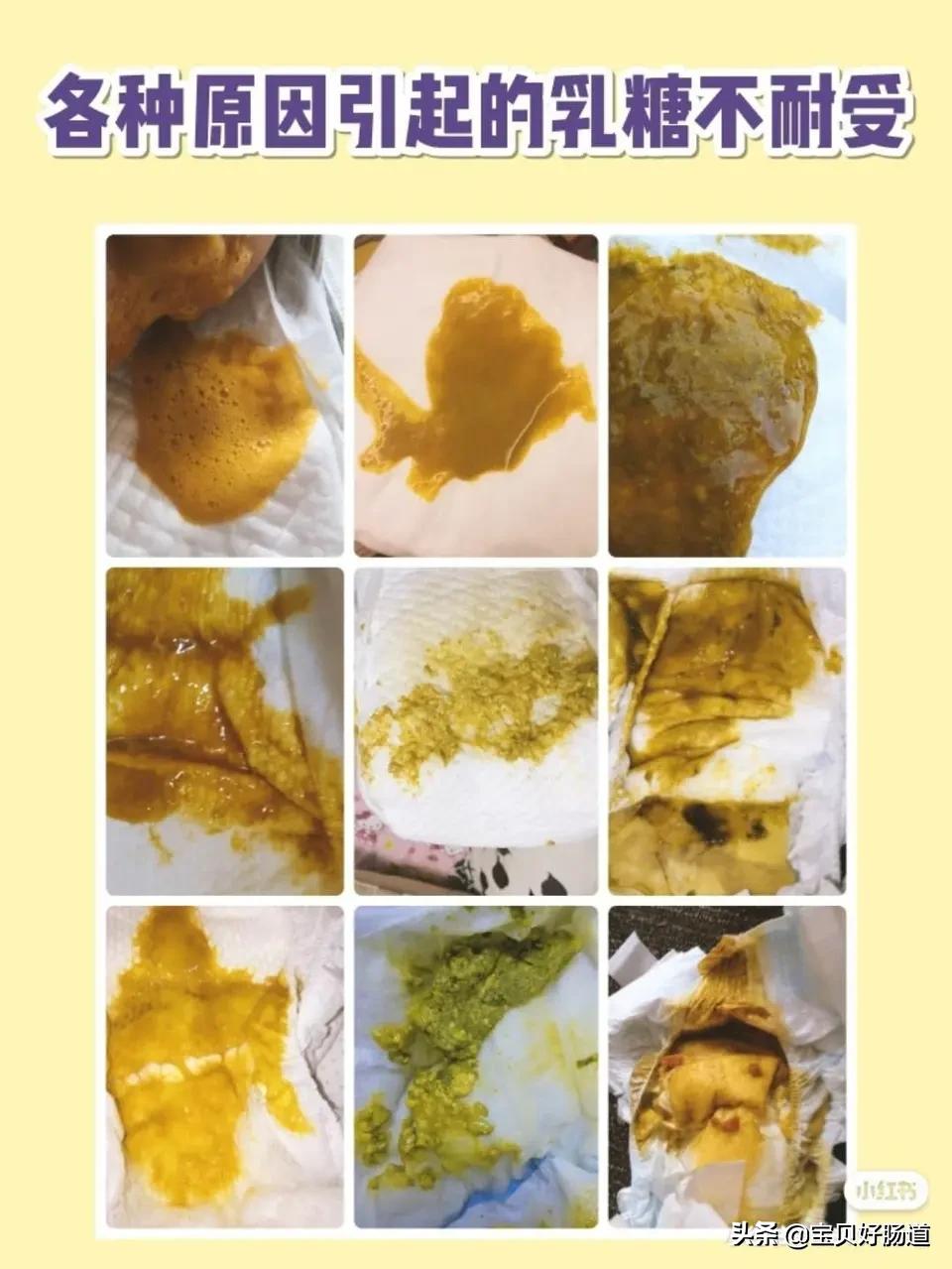 宝宝拉肚子和吃药有没有关系,乱吃治拉肚子的药有什么后果