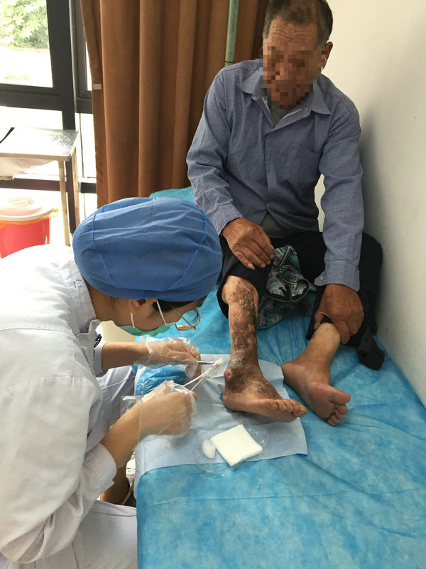 优质护理服务推进,优质护理服务延伸服务计划