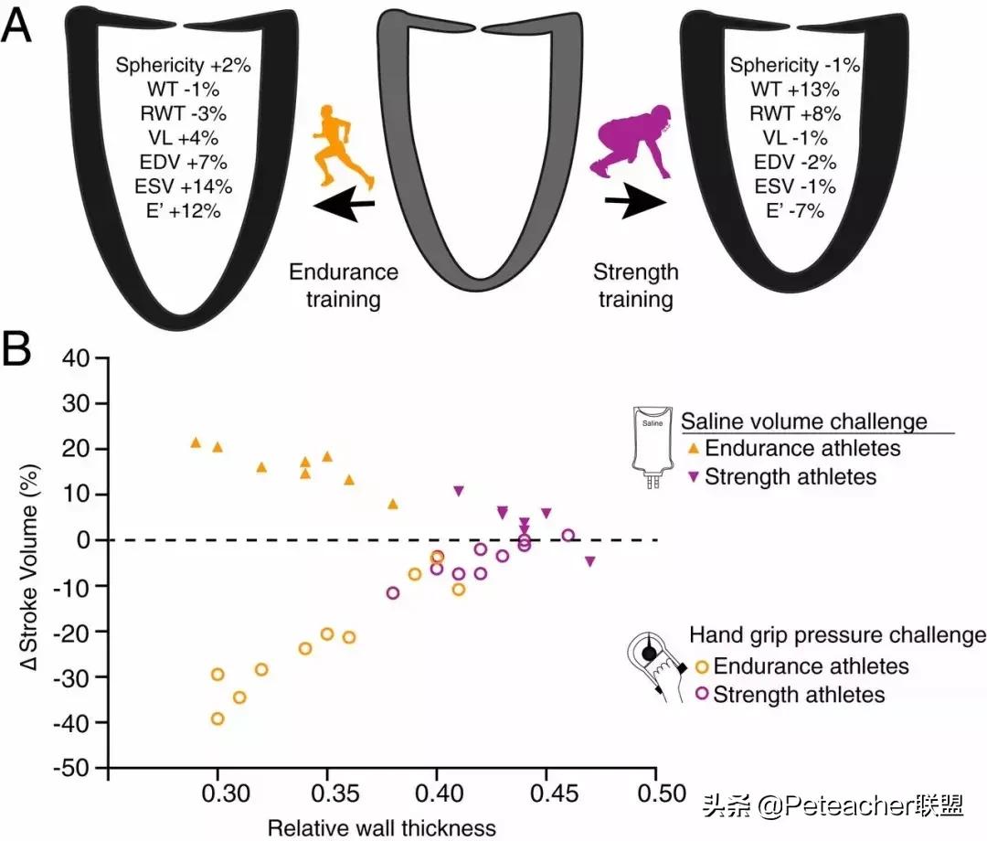 运动员心脏：120年的争议与发展