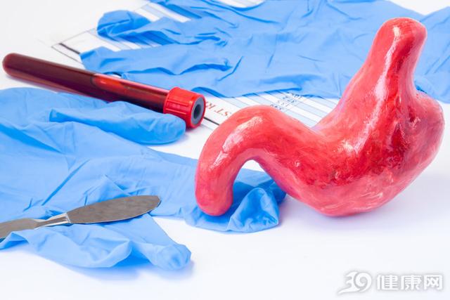 烧心反酸怎么治疗能除根,胃酸分泌不足引起反酸烧心吗